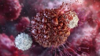Cancer image