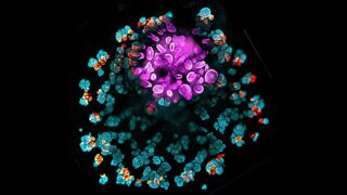 Lab-grown kidney organoid