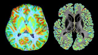 Brain images