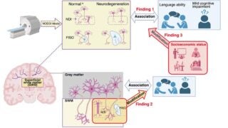 Gray matter study findings