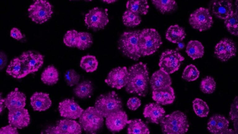 liver cells